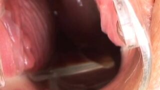 Deepthroat teen gapes hole with speculum