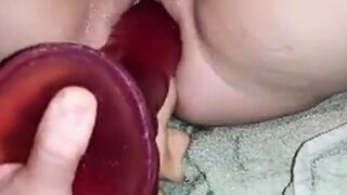 Anal och vaginal strckning